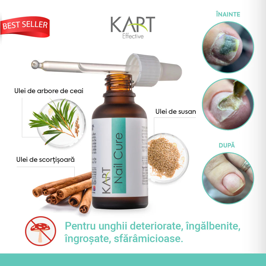 Nail Cure Solutie Antimicotica pentru Unghii Kart - 30ml