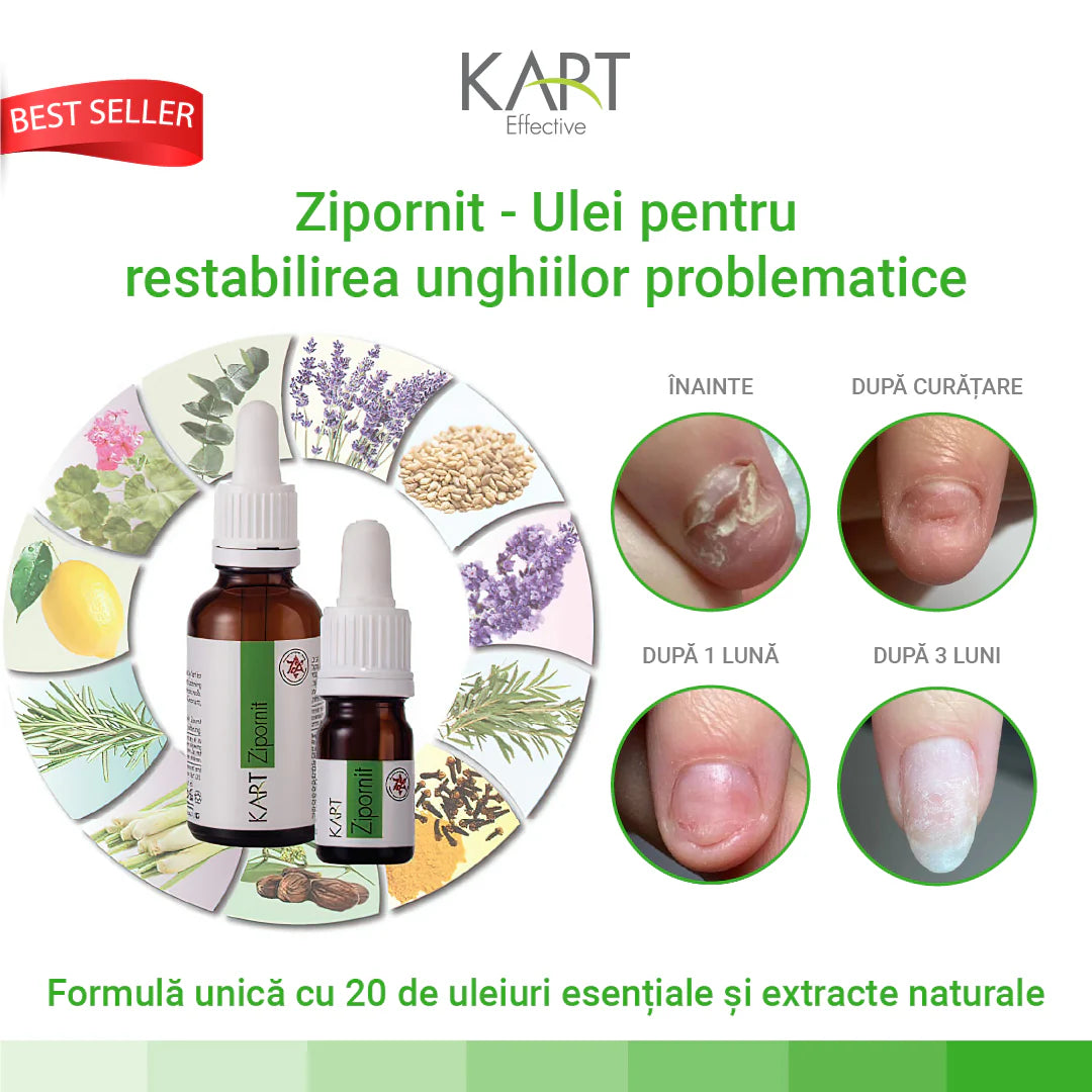 Zipornit Kart - 30ml